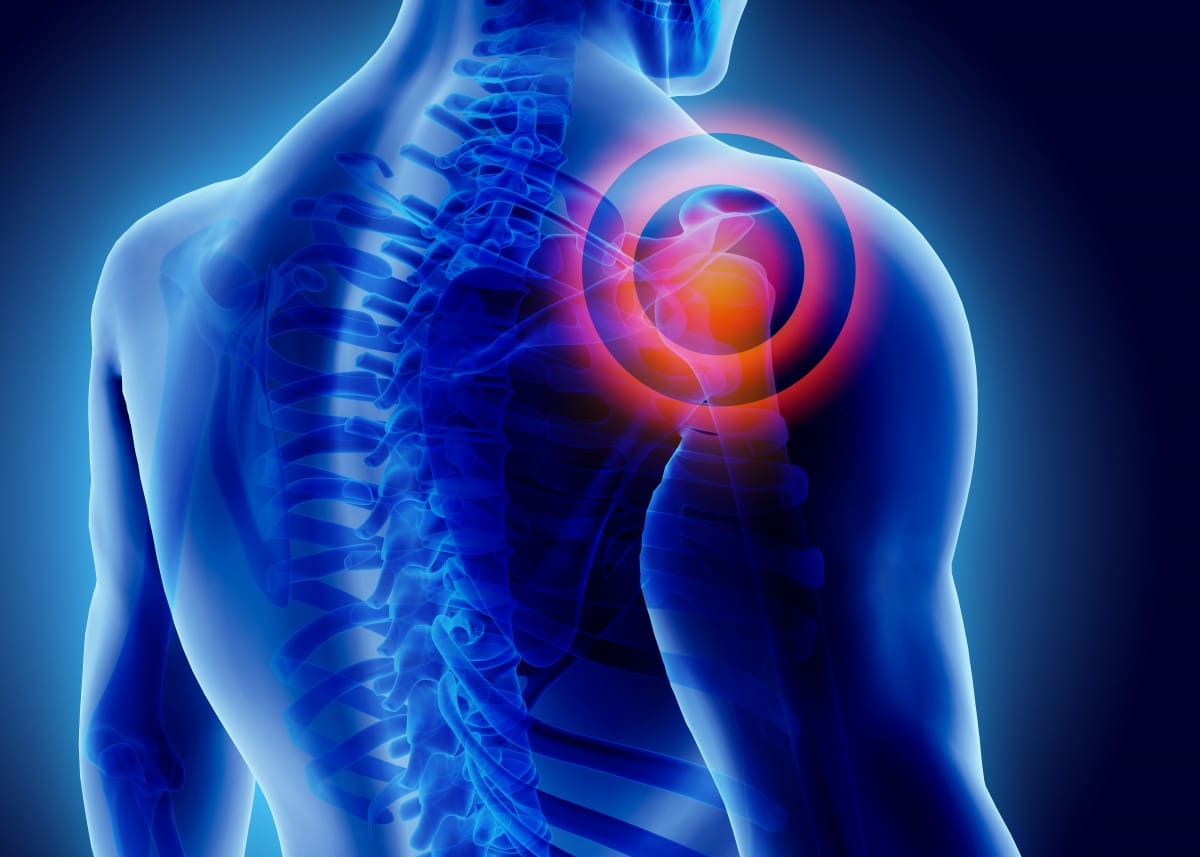 workers-compensation-benefits-for-shoulder-injuries