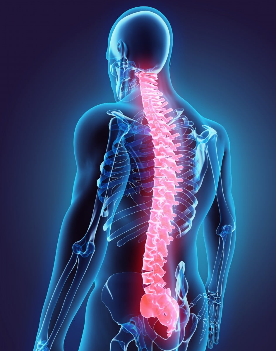  Spinal Cord Injury SCI 